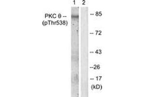 Western blot analysis of extracts from Jurkat cells, using PKC thet (Phospho-Thr538) Antibody. (PKC theta antibody  (pThr538))