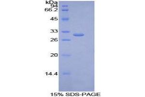 SDS-PAGE (SDS) image for Lipase, Endothelial (LIPG) (AA 175-412) protein (His tag) (ABIN2125688)