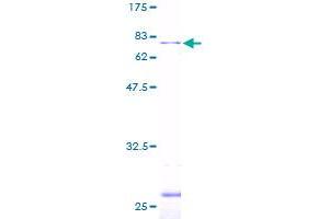 Leupaxin Protein (LPXN) (AA 1-386) (GST tag)