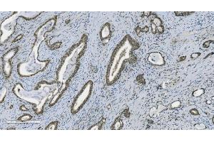 IHC analysis of PARP using anti-PARP antibody (ABIN7602278). (PARP1 antibody  (AA 670-858))