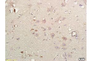 Neuroglobin antibody  (AA 51-151)