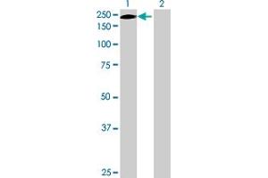 Western Blot analysis of ERCC5 expression in transfected 293T cell line by ERCC5 MaxPab polyclonal antibody.