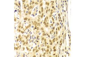 Immunohistochemistry (IHC) image for anti-BMI1 Polycomb Ring Finger Oncogene (BMI1) (AA 120-326) antibody (ABIN3020691)