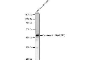 Western blot analysis of extracts of Mouse stomach, using Cytokeratin 17 (KRT17) antibody (ABIN6130112, ABIN6143023, ABIN6143024 and ABIN6213626) at 1:1298 dilution. (KRT17 antibody  (AA 133-432))