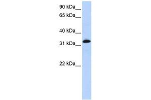 Troponin T Type 2 antibody used at 1 ug/ml to detect target protein. (Cardiac Troponin T2 antibody)