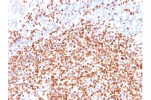 Formalin-fixed, paraffin-embedded human Lymph Node stained with Oct-2 Mouse Monoclonal Antibody (OCT2/2137). (Oct-2 antibody  (AA 112-297))