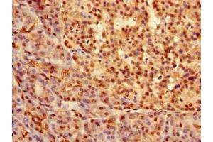 Immunohistochemistry of paraffin-embedded human pancreatic tissue using ABIN7172642 at dilution of 1:100 (SOX9 antibody  (AA 296-501))