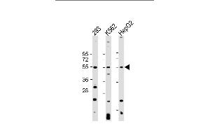 All lanes : Anti-VEGFC Antibody at 1:2000 dilution Lane 1: 293 whole cell lysate Lane 2: K562 whole cell lysate Lane 3: HepG2 whole cell lysate Lysates/proteins at 20 μg per lane. (VEGFC antibody)