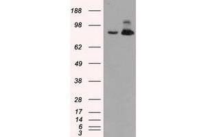 HEK293T cells were transfected with the pCMV6-ENTRY control (Left lane) or pCMV6-ENTRY ACO2 (Right lane) cDNA for 48 hrs and lysed. (ACO2 antibody)