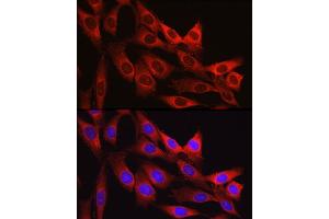 Immunofluorescence (IF) image for anti-Vinculin (VCL) (AA 767-1066) antibody (ABIN6150070)