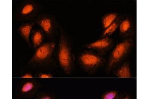 Immunofluorescence analysis of U-2 OS cells using SUPT6H Polyclonal Antibody at dilution of 1:100. (Spt6 antibody)