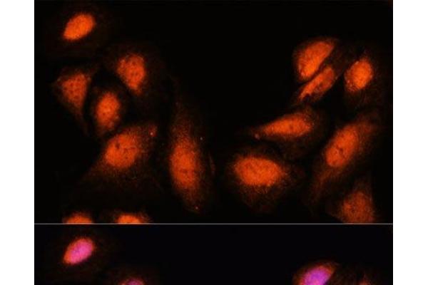 Spt6 antibody