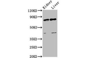 Western Blot Positive WB detected in: Rat kidney tissue, Rat liver tissue All lanes: SUZ12 antibody at 3. (SUZ12 antibody  (AA 131-305))