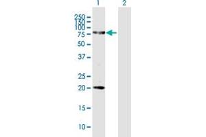 Western Blot analysis of FERMT1 expression in transfected 293T cell line by FERMT1 MaxPab polyclonal antibody. (FERMT1 antibody  (AA 1-677))