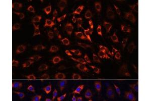 Immunofluorescence analysis of C6 cells using ERK1 / ERK2 Polyclonal Antibody at dilution of 1:100 (40x lens). (ERK1/2 antibody)