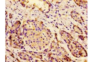 Immunohistochemistry (IHC) image for anti-Calcium Channel, Voltage-Dependent, L Type, alpha 1C Subunit (CACNA1C) (AA 1755-1971) antibody (ABIN7175586)