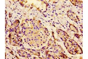 Immunohistochemistry of paraffin-embedded human pancreatic tissue using ABIN7175586 at dilution of 1:100 (CACNA1C antibody  (AA 1755-1971))