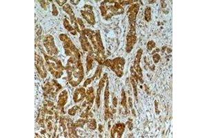 Immunohistochemical analysis of Alpha-tubulin (AcK40) staining in human breast cancer,mouse brain formalin fixed paraffin embedded tissue section. (alpha Tubulin antibody  (acLys40))