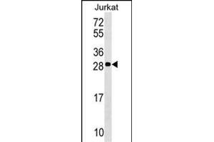 ANP32C Antibody (Center) (ABIN1537820 and ABIN2848975) western blot analysis in Jurkat cell line lysates (35 μg/lane).