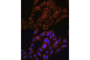 Immunofluorescence analysis of C6 cells using CHCHD2 antibody (ABIN7266448) at dilution of 1:100. (CHCHD2 antibody  (AA 75-145))