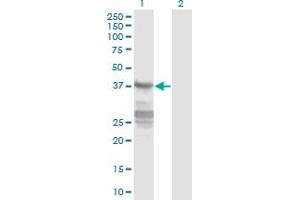 Western Blotting (WB) image for anti-Calponin 3, Acidic (CNN3) (AA 1-329) antibody (ABIN961518) (CNN3 antibody  (AA 1-329))