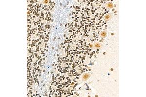 Immunohistochemistry of paraffin embedded rat cerebellum using USP27 (ABIN7076113) at dilution of 1:700 (400x lens) (USP27X antibody)