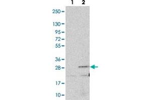 Western blot analysis of Lane 1: Negative control (vector only transfected HEK293T lysate). (ANKRD39 antibody)