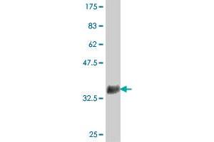 Western Blot detection against Immunogen (37 KDa) . (ZNF598 antibody  (AA 28-126))