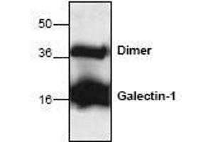 Image no. 1 for anti-Lectin, Galactoside-Binding, Soluble, 1 (LGALS1) antibody (ABIN127228) (LGALS1/Galectin 1 antibody)