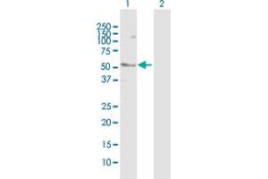 Western Blot analysis of SMYD2 expression in transfected 293T cell line by SMYD2 MaxPab polyclonal antibody. (SMYD2A antibody  (AA 1-433))