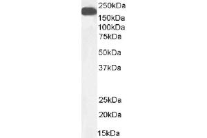 Western Blot using anti-carcinoembryonic antigen antibody A5B7. (Recombinant CEA antibody)