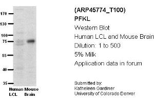 Image no. 2 for anti-Phosphofructokinase, Liver (PFKL) (Middle Region) antibody (ABIN2782359) (PFKL antibody  (Middle Region))