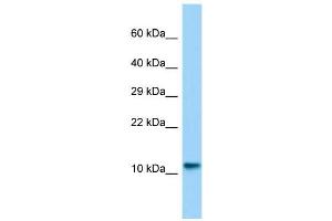 Host:  Rabbit  Target Name:  Lsm10  Sample Type:  Rat Testis lysates  Antibody Dilution:  1. (LSM10 antibody  (N-Term))