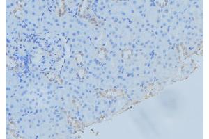 ABIN6279466 at 1/100 staining Mouse kidney tissue by IHC-P. (SAR1A antibody  (Internal Region))
