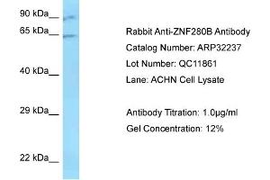 Western Blotting (WB) image for anti-Zinc Finger Protein 280B (ZNF280B) (N-Term) antibody (ABIN2779515) (ZNF280B antibody  (N-Term))