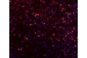 Immunofluorescence (IF) image for anti-Inducible T-Cell Co-Stimulator (ICOS) antibody (Alexa Fluor 647) (ABIN2657722) (ICOS antibody  (Alexa Fluor 647))
