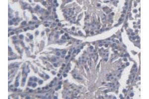 Detection of FKBPL in Mouse Testis Tissue using Polyclonal Antibody to FK506 Binding Protein Like Protein (FKBPL) (FKBPL antibody  (AA 1-347))