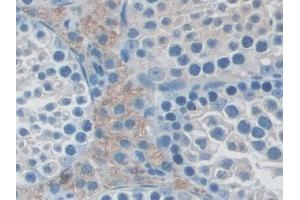 Detection of NXN in Mouse Testis Tissue using Polyclonal Antibody to Nucleoredoxin (NXN) (NXN antibody  (AA 167-435))