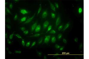 Immunofluorescence of monoclonal antibody to USP33 on HeLa cell. (USP33 antibody  (AA 327-426))