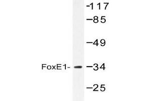 Western blot (WB) analysis of FoxE1 antibody in extracts from HUVEC cells. (FOXE1 antibody)