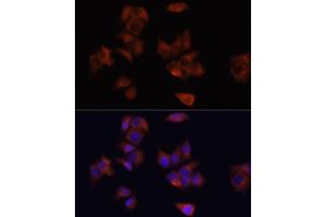 Immunofluorescence analysis of HeLa cells using L antibody (ABIN6130048, ABIN6143079, ABIN6143080 and ABIN6215226) at dilution of 1:100. (LAMP1 antibody  (AA 80-280))