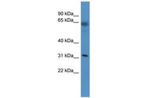 OR2T5 antibody  (C-Term)