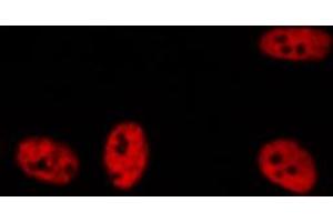 ABIN6272258 staining A549 by IF/ICC. (BRD3 antibody  (C-Term))