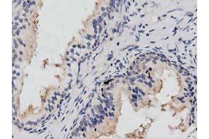 Immunohistochemical staining of paraffin-embedded Human prostate tissue using anti-PTPRE mouse monoclonal antibody.
