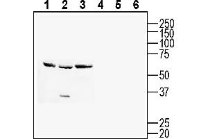 Western blot analysis of mouse  T-cell lymphoma cell line lysate (lanes 1 and 4), mouse J774 macrophage cell line lysate (lanes 2 and 5) and mouse WEHI B-cell lymphoma cell line lysate (lanes 3 and 6):1-3.