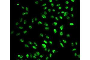 Immunofluorescence analysis of A549 cell using SETD2 antibody. (SETD2 antibody  (AA 803-1103))