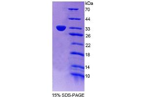 Phospholipid Scramblase 5 (PLSCR5) (AA 1-274) protein (T7 tag,His tag)