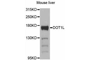 Western blot analysis of extracts of mouse liver, using DOT1L antibody (ABIN5997610) at 1/1000 dilution. (DOT1L antibody)