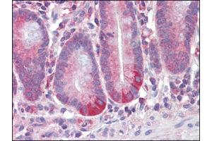 Human Small Intestine (formalin-fixed, paraffin-embedded) stained with RETNLBfollowed by biotinylated anti-goat IgG secondary antibody, alkaline phosphatase-streptavidin and chromogen. (RETNLB antibody  (Internal Region))