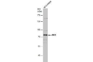 WB Image MX1 antibody detects MX1 protein by western blot analysis.